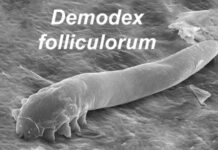 Gözde yanma, sulanma ve kaşıntı varsa demodex parazitine dikkat!