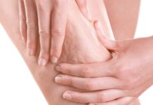 Prof. Dr. Karacalar: Selülit sadece estetik bir sorun değil