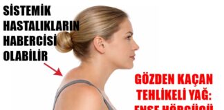Uzmanı açıkladı: Ense hörgücü ciddi sağlık sorunlarına yol açabilir!