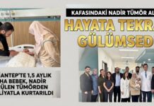 Dünyada nadir görülen başarı! Gaziantep Şehir Hastanesi’nde 1,5 aylık bebeğe dev tümör ameliyatı